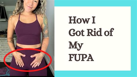 Excess fat over the area right between your hips and above your pubic bone is sometimes known by the slang term "FUPA" (fat upper pubic area). . What does fupa look like